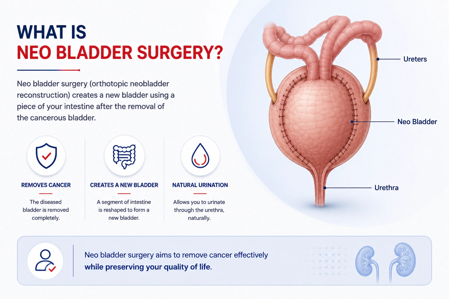 Overview of neo bladder surgery