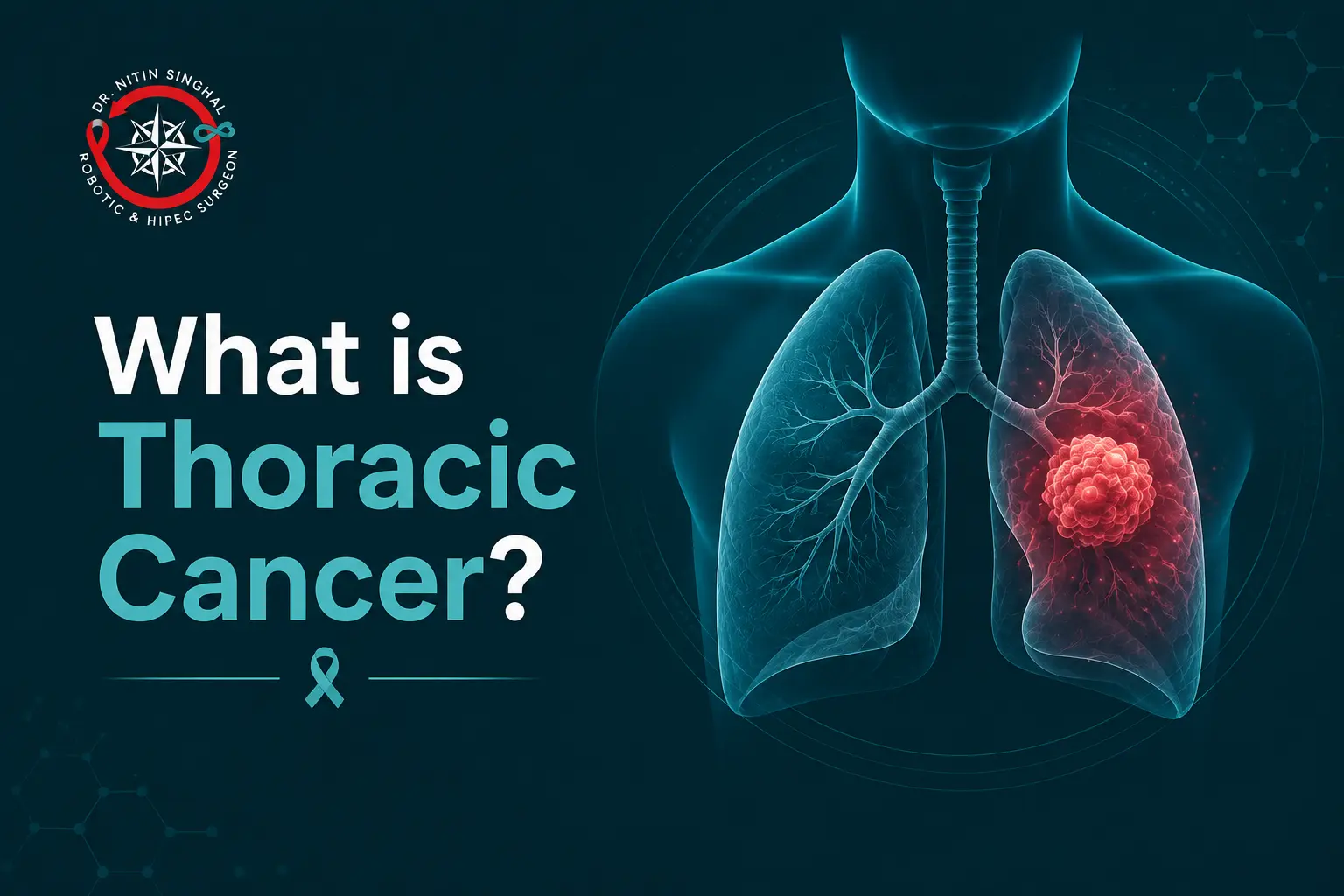 What is thoracic cancer — overview by Dr. Nitin Singhal, robotic thoracic cancer surgeon, Ahmedabad