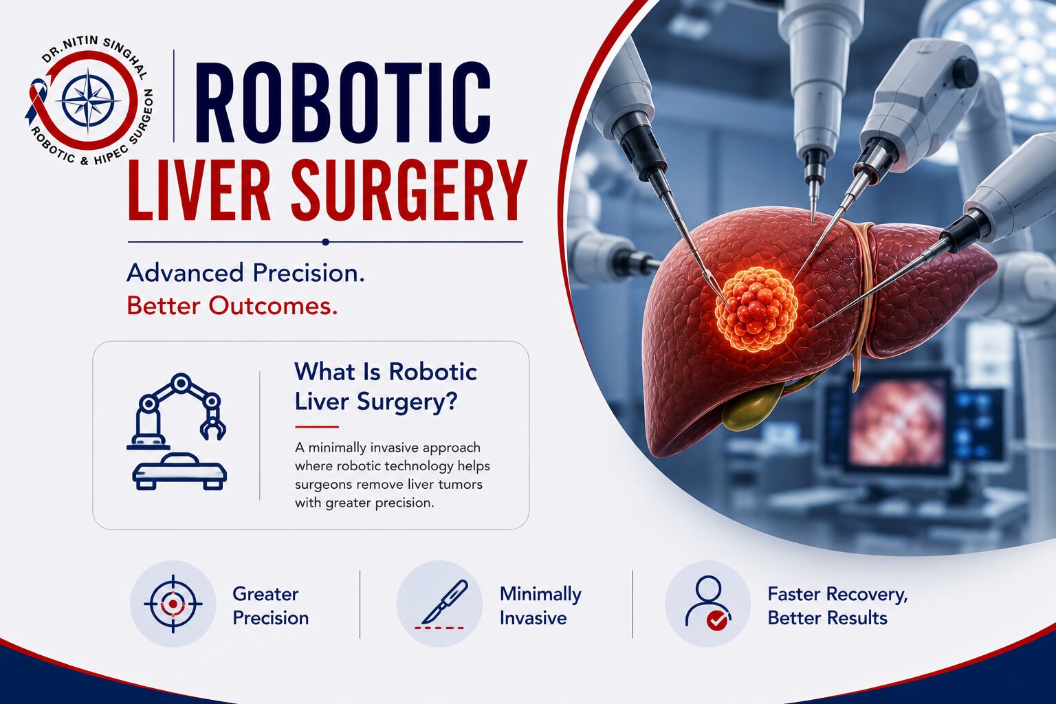 Robotic liver cancer surgery illustration, Dr. Nitin Singhal Ahmedabad