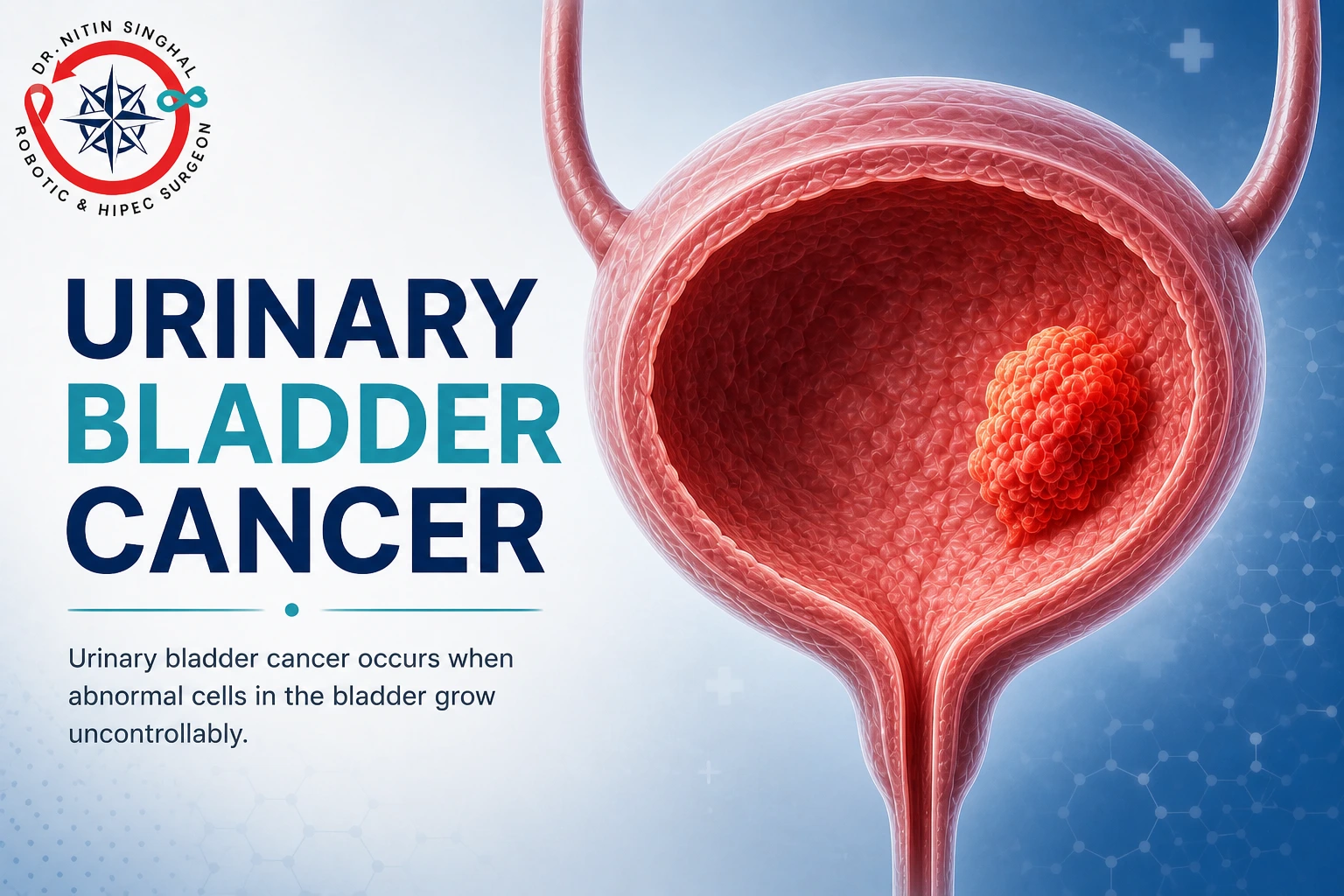 Robotic bladder cancer surgery — Dr. Nitin Singhal, Ahmedabad