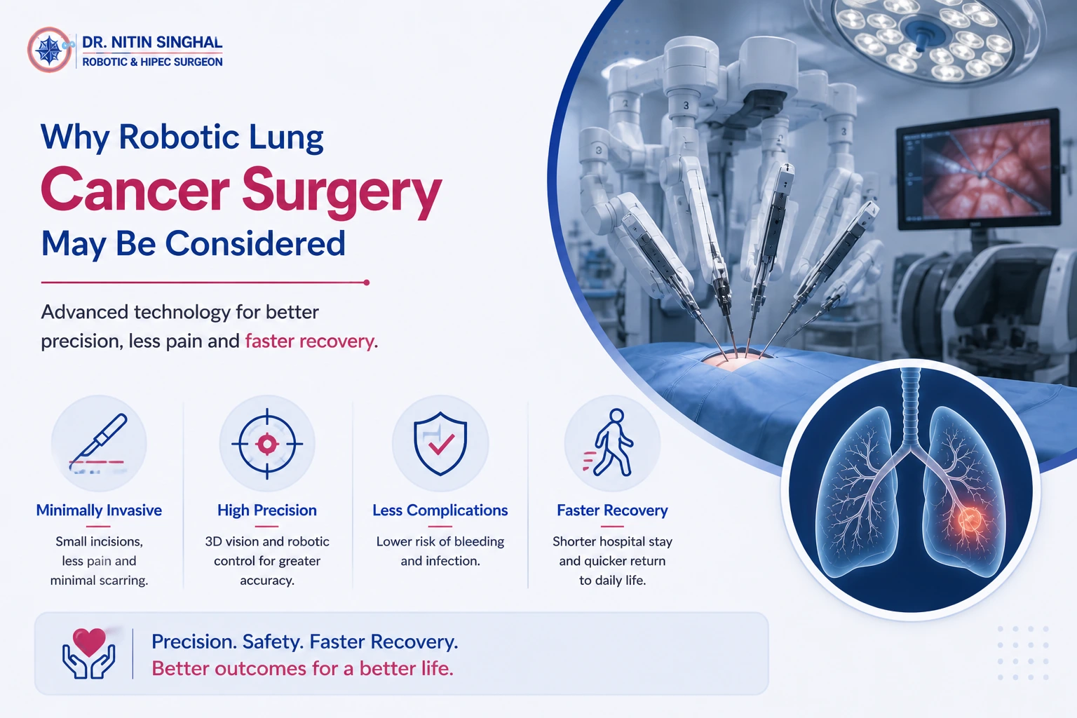 Why consider robotic lung surgery illustration