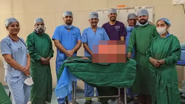 3.1 kg Wilms tumor removed from child stomach — Dr Nitin Singhal pediatric oncology, Ahmedabad