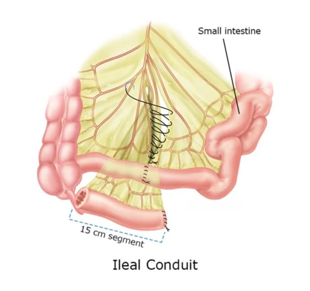 DR. NITIN SINGHAL (90)